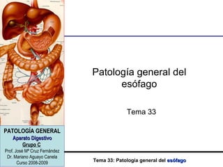 Patología general del esófago Tema 33 
