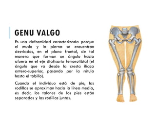 Angulo Tobillo TEMA 38 - MALFORMACIONES DE RODILLA Y CADERA.pdf