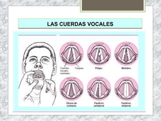 LAS CUERDAS VOCALES
 