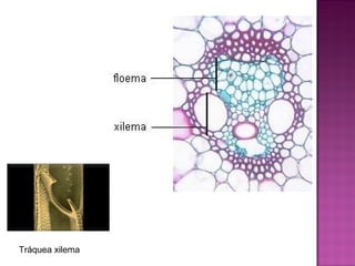 Tráquea xilema
 