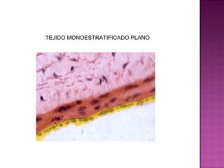TEJIDO MONOESTRATIFICADO PLANO
 