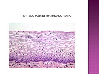 EPITELIO PLURIESTRATIFICADO PLANO
 