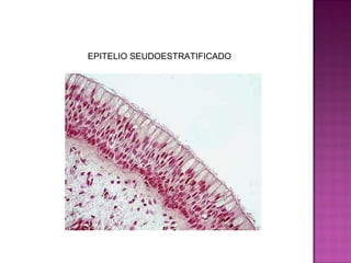 EPITELIO SEUDOESTRATIFICADO
 