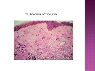 TEJIDO CONJUNTIVO LAXO
 