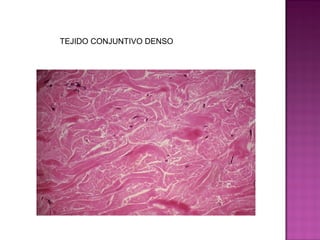 TEJIDO CONJUNTIVO DENSO
 