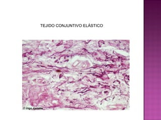 TEJIDO CONJUNTIVO ELÁSTICO
 