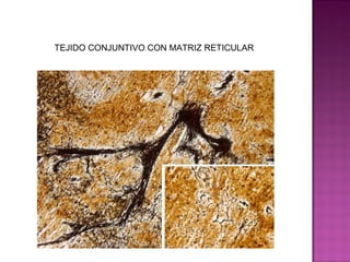 TEJIDO CONJUNTIVO CON MATRIZ RETICULAR
 