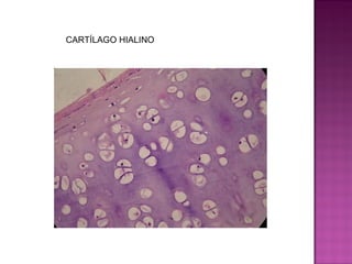 CARTÍLAGO HIALINO
 