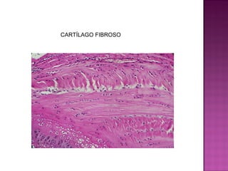 CARTÍLAGO FIBROSO
 