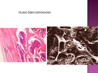 TEJIDO ÓSEO ESPONJOSO
 
