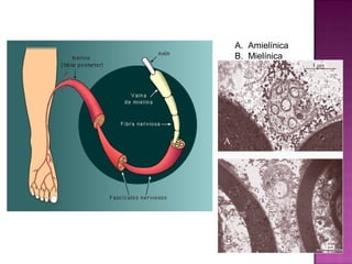 A. Amielínica
B. Mielínica
 