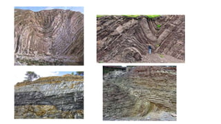 Tema 3 - Deformaciones corticales