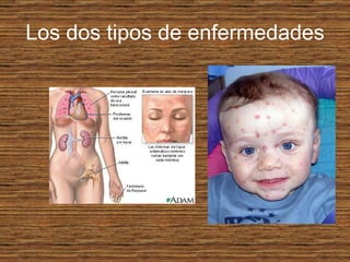 Los dos tipos de enfermedades 