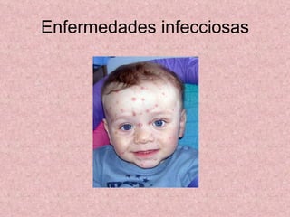 Enfermedades infecciosas 