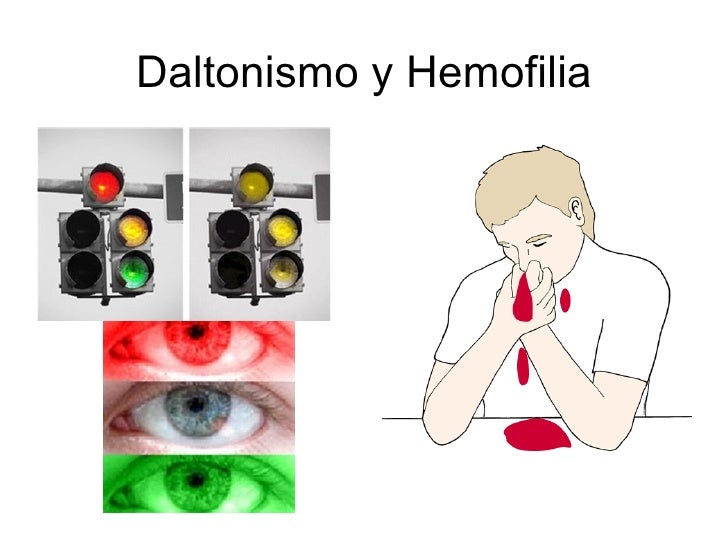 Tema 3 las leyes de la herencia