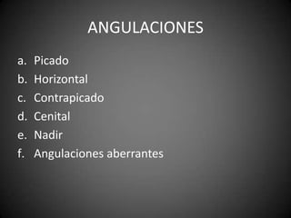 ANGULACIONESPicado Horizontal ContrapicadoCenital NadirAngulaciones aberrantes 