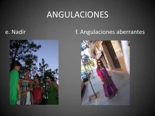 ANGULACIONESe. Nadirf. Angulaciones aberrantes 
