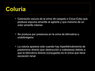Coluria
• Coloración oscura de la orina (té cargado o Coca-Cola) que
produce espuma amarilla al agitarla y que mancha de un
color amarillo intenso
• Se produce por presencia en la orina de bilirrubina o
urobilinógeno
• La coluria aparece solo cuando hay hiperbilirrubinemia de
predominio directo (por obstrucción o colestasia) debido a
que la bilirrubina directa (conjugada) es la única que tiene
excreción renal
 