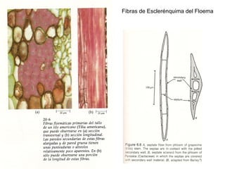 Fibras de Esclerénquima del Floema
 