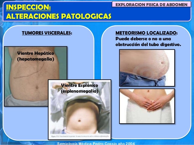 Tema 4. exploracion de abdomen
