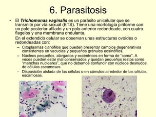 6. Parasitosis
• El Trichomonas vaginalis es un parásito unicelular que se
transmite por vía sexual (ETS). Tiene una morfología piriforme con
un polo posterior afilado y un polo anterior redondeado, con cuatro
flagelos y una membrana ondulante.
En el extendido celular se observan unas estructuras ovoides o
redondeadas con:
– Citoplasmas cianófilos que pueden presentar cambios degenerativos
consistentes en vacuolas y pequeños gránulos eosinófilos.
– Núcleos pequeños, alargados y excéntricos en forma de “coma”. A
veces pueden estar mal conservados y quedan pequeños restos como
“manchas nucleares”, que no debemos confundir con núcleos desnudos
de células escamosas.
– Disposición aislada de las células o en cúmulos alrededor de las células
escamosas.
 