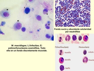 M: macrófagos; L:linfocitos; E:
polimorfonucleares eosinófilos. Todo
ello en un fondo discretamente mucoide.
Fondo sucio y abundante celularidad
por neutrófilos
Polen
 