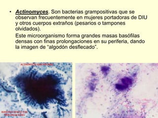 • Actinomyces. Son bacterias grampositivas que se
observan frecuentemente en mujeres portadoras de DIU
y otros cuerpos extraños (pesarios o tampones
olvidados).
Este microorganismo forma grandes masas basófilas
densas con finas prolongaciones en su periferia, dando
la imagen de “algodón desflecado”.
 