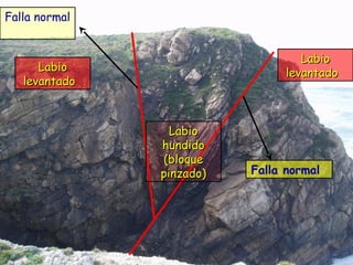 LabioLabio
levantadolevantado
LabioLabio
levantadolevantado
LabioLabio
hundidohundido
(bloque(bloque
pinzado)pinzado)
Falla normal
Falla normal
 
