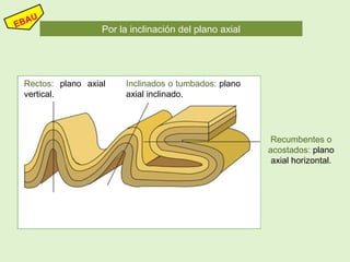 Por la inclinación del plano axial
Rectos: plano axial
vertical.
Inclinados o tumbados: plano
axial inclinado.
Recumbentes o
acostados: plano
axial horizontal.
 