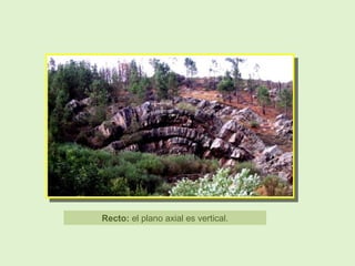 Recto: el plano axial es vertical.
 