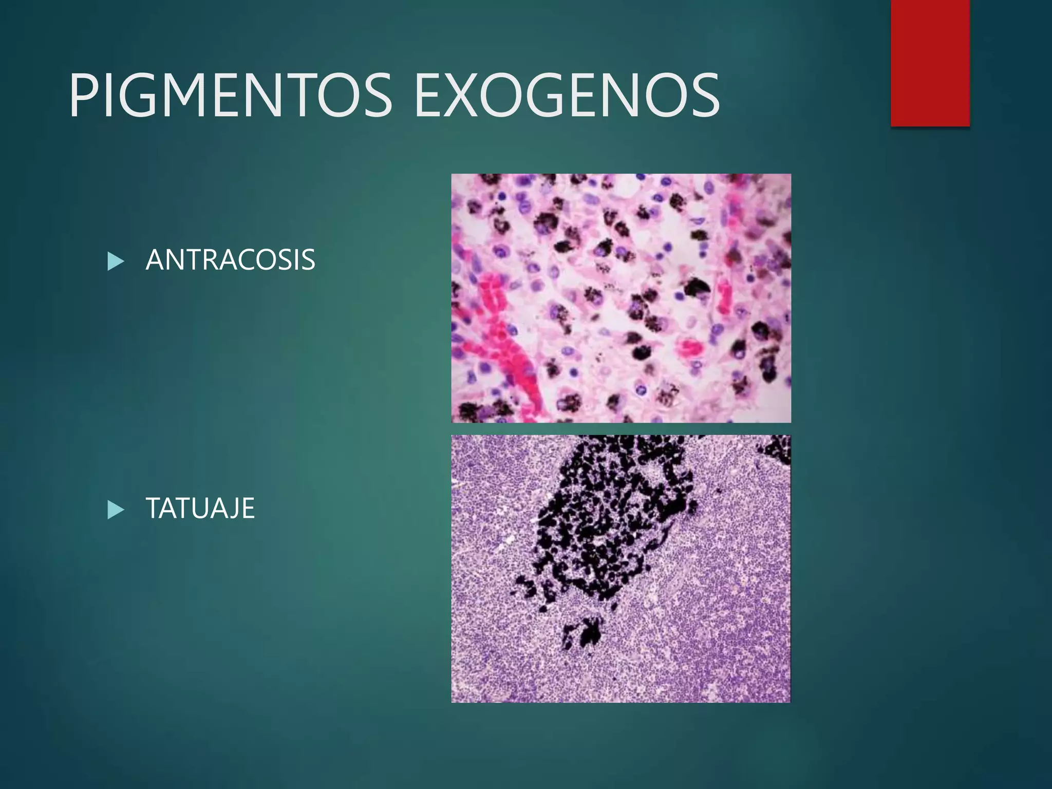 PIGMENTOS EXOGENOS
 ANTRACOSIS
 TATUAJE
 