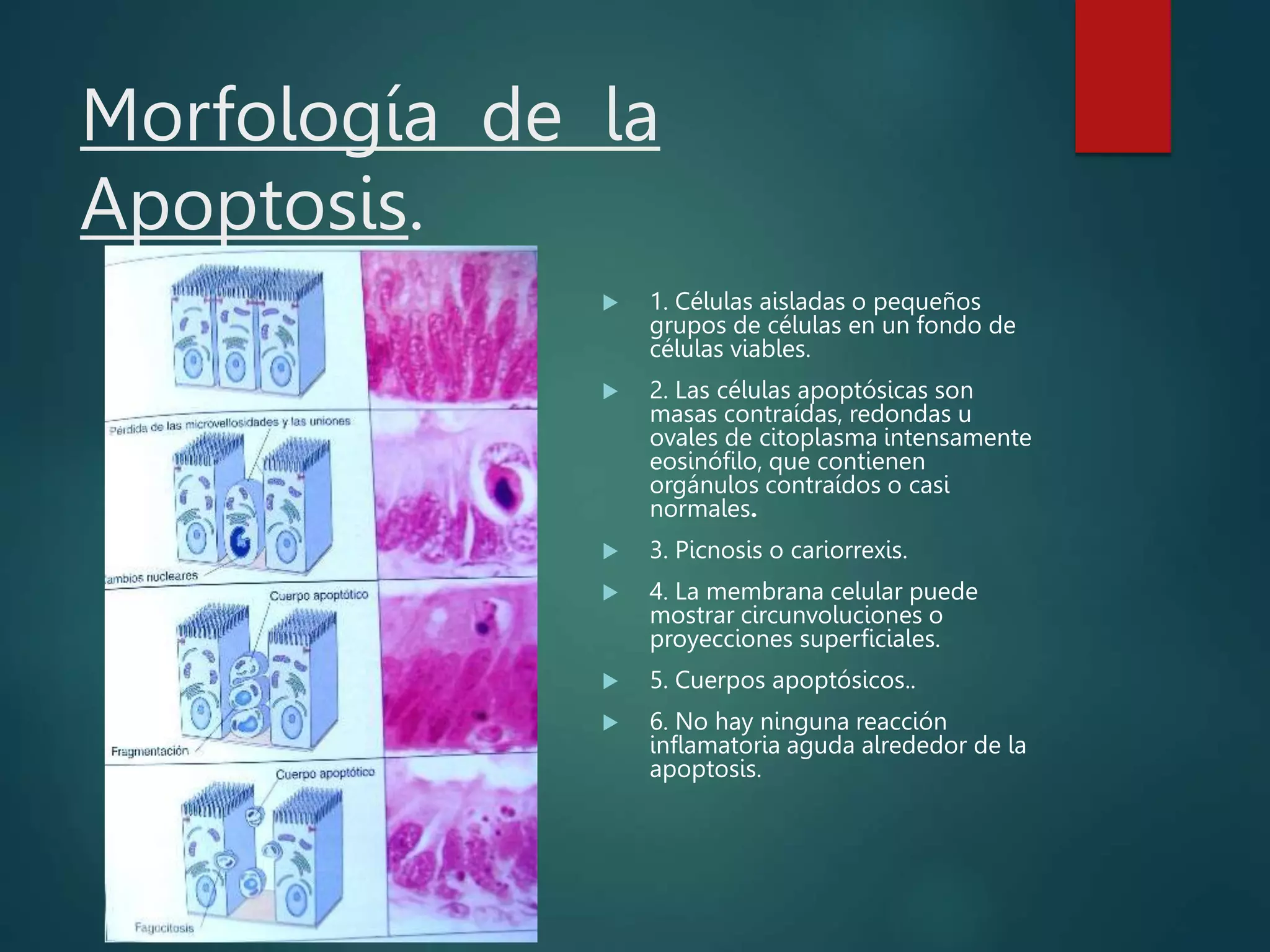 Morfología de la
Apoptosis.
 1. Células aisladas o pequeños
grupos de células en un fondo de
células viables.
 2. Las células apoptósicas son
masas contraídas, redondas u
ovales de citoplasma intensamente
eosinófilo, que contienen
orgánulos contraídos o casi
normales.
 3. Picnosis o cariorrexis.
 4. La membrana celular puede
mostrar circunvoluciones o
proyecciones superficiales.
 5. Cuerpos apoptósicos..
 6. No hay ninguna reacción
inflamatoria aguda alrededor de la
apoptosis.
 