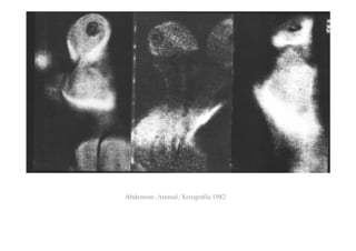 Abdemour, Ammal, Xerografía 1982
 