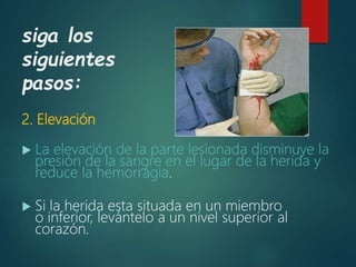 siga los
siguientes
pasos:
2. Elevación
 La elevación de la parte lesionada disminuye la
presión de la sangre en el lugar de la herida y
reduce la hemorragia.
 Si la herida esta situada en un miembro
o inferior, levántelo a un nivel superior al
corazón.
 