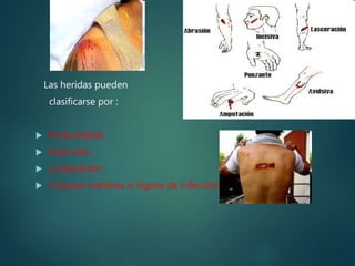Las heridas pueden
clasificarse por :
 Profundidad.
 Extensión.
 Localización.
 Cuerpos extraños o signos de infección.
 