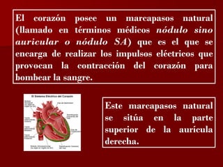 ?

El corazón posee un marcapasos natural
(llamado en términos médicos nódulo sino
auricular o nódulo SA) que es el que se
encarga de realizar los impulsos eléctricos que
provocan la contracción del corazón para
bombear la sangre.

                     Este marcapasos natural
                     se sitúa en la parte
                     superior de la aurícula
                     derecha.
 