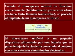 ?

Cuando el marcapasos natural no funciona
correctamente (habitualmente provoca un ritmo
cardíaco lento llamado bradicardia), se procede
al implante de un marcapasos artificial.




El marcapasos artificial es un pequeño
dispositivo alimentado por una batería que se
pone debajo de la clavícula conectado al corazón
con unos catéteres denominados electrodos.
 