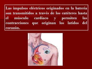 ?

Las impulsos eléctricos originados en la batería
son transmitidos a través de los catéteres hasta
el músculo cardíaco y permiten las
contracciones que originan los latidos del
corazón.
 
