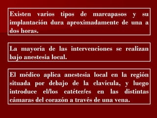 ?

Existen varios tipos de marcapasos y su
implantación dura aproximadamente de una a
dos horas.

La mayoría de las intervenciones se realizan
bajo anestesia local.

El médico aplica anestesia local en la región
situada por debajo de la clavícula, y luego
introduce el/los catéter/es en las distintas
cámaras del corazón a través de una vena.
 