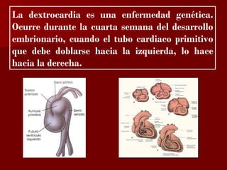 ?
La dextrocardia es una enfermedad genética.
Ocurre durante la cuarta semana del desarrollo
embrionario, cuando el tubo cardiaco primitivo
que debe doblarse hacia la izquierda, lo hace
hacia la derecha.
 
