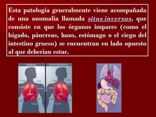 ?
Esta patología generalmente viene acompañada
de una anomalía llamada situs inversus, que
consiste en que los órganos impares (como el
hígado, páncreas, bazo, estómago o el ciego del
intestino grueso) se encuentran en lado opuesto
al que deberían estar.
 
