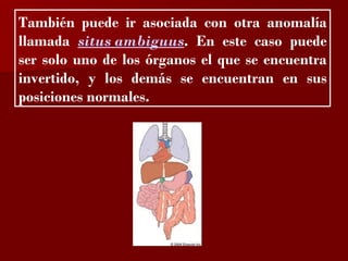 ?
También puede ir asociada con otra anomalía
llamada situs ambiguus. En este caso puede
ser solo uno de los órganos el que se encuentra
invertido, y los demás se encuentran en sus
posiciones normales.
 