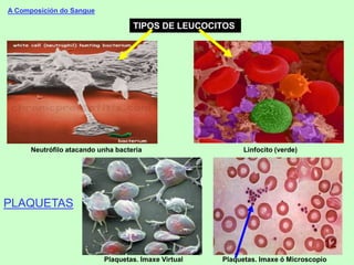 A Composición do Sangue
TIPOS DE LEUCOCITOS
Neutrófilo atacando unha bacteria Linfocito (verde)
PLAQUETAS
Plaquetas. Imaxe Virtual Plaquetas. Imaxe ó Microscopio
 