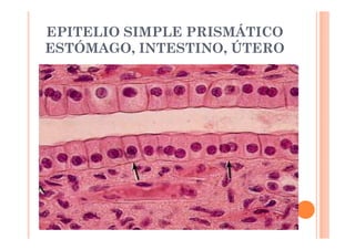 EPITELIO SIMPLE PRISMÁTICO 
ESTÓMAGO, INTESTINO, ÚTERO 
cilios 
Epitelio 
prismático 
simple 
 