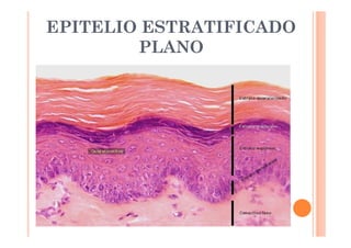 EPITELIO ESTRATIFICADO 
PLANO 
 