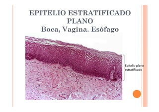 EPITELIO ESTRATIFICADO 
PLANO 
Boca, Vagina. Esófago 
Epitelio plano 
estratificado 
 