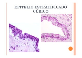 EPITELIO ESTRATIFICADO 
CÚBICO 
 