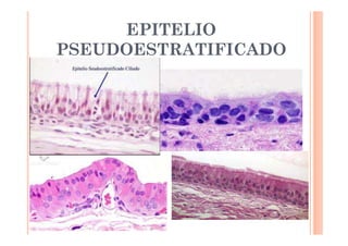 EPITELIO 
PSEUDOESTRATIFICADO 
 