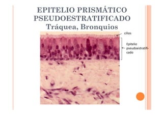 EPITELIO PRISMÁTICO 
PSEUDOESTRATIFICADO 
Tráquea, Bronquios 
cilios 
Epitelio 
pseudoestratifi-cado 
 