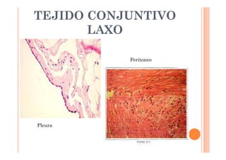 TEJIDO CONJUNTIVO 
LAXO 
Pleura 
Peritoneo 
 